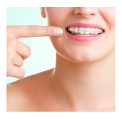 Orthodontics - Invisalign